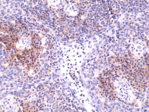 Immunohistochemical staining of formalin fixed and paraffin embedded human Tonsil tissue sections using Anti-Integrin alpha 4 Rabbit Monoclonal Antibody (Clone RM268) at a 1:5000 dilution.