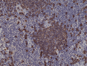 Immunohistochemical staining of formalin fixed and paraffin embedded human tonsil tissue sections using Anti-CD20 Rabbit Monoclonal Antibody (Clone RM272) at a 1:1000 dilution.