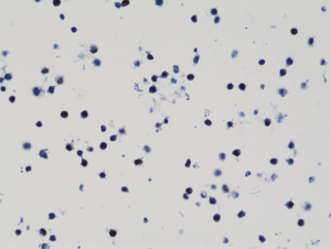 anti-Histone H3 K9M (human), Rabbit Monoclonal (RM191)