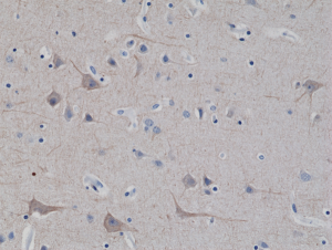 Immunohistochemical staining of formalin fixed and paraffin embedded human brain tissue sections using Anti-Neurofilament-L (NF-L) Rabbit Monoclonal Antibody (Clone RM280) at a 1:2500 dilution.