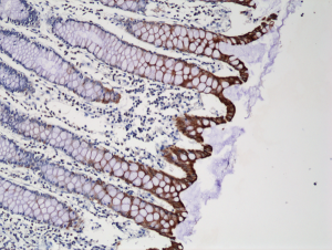 Immunohistochemical staining of formalin fixed and paraffin embedded human colon tissue sections using Anti-CK20 Rabbit Monoclonal Antibody (Clone RM283) at a 1:250 dilution.