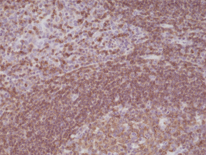Immunohistochemical staining of formalin fixed and paraffin embedded human tonsil tissue sections using Anti-CD45 Rabbit Monoclonal Antibody (Clone RM291) at a 1:200 dilution.