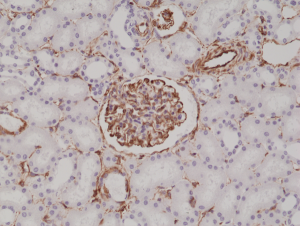 Immunohistochemical staining of formalin fixed and paraffin embedded human kidney tissue sections using anti-Vimentin rabbit monoclonal antibody (clone RM289) at a 1:200 dilution.