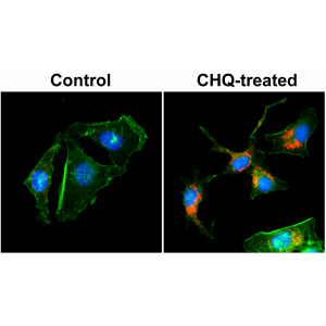 Immunocytochemical staining of HeLa cells untreated or treated with chloroquine (CHQ), using anti-LC3B rabbit monoclonal Antibody Clone RM293 (red) at a 1:200 dilution. Actin filaments have been labeled with fluorescein phalloidin (green), and nucleus labeled with DAPI (blue).
