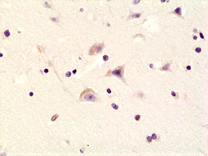 Immunohistochemical staining of formalin fixed and paraffin embedded human brain tissue sections using Anti-Phospho-AMPA Receptor (GluR 1) (Ser845) rabbit monoclonal antibody (clone RM296) at a 1:200 dilution.