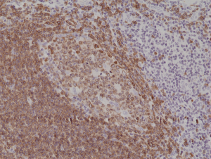 Immunohistochemical staining of formalin fixed and paraffin embedded human tonsil tissue section using anti-CD79a rabbit monoclonal antibody (Clone RM297) at a 1:200 dilution.