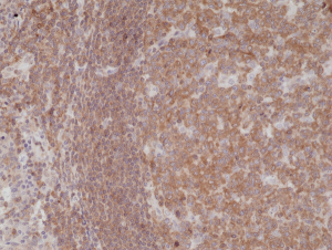 Immunohistochemical staining of formalin fixed and paraffin embedded human tonsil tissue section using anti-NF-kappa-B p105/p50 rabbit monoclonal antibody (clone RM299) at a 1:200 dilution.
