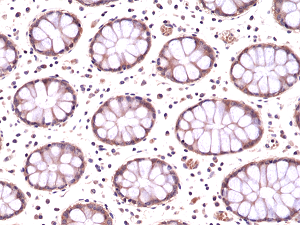 Immunohistochemical staining of formalin fixed and paraffin embedded human colon tissue section using anti-AMPK alpha-1 rabbit monoclonal antibody (clone RM301) at a 1:200 dilution.