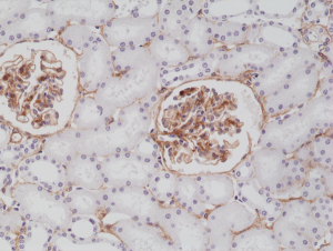 Immunohistochemical staining of formalin fixed and paraffin embedded human kidney tissue section using anti-CD140b rabbit monoclonal antibody (Clone RM303) at a 1:200 dilution.