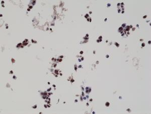 Immunohistochemistry staining of na?ve HepG2 cells (Negative control) using anti-His-Tag antibody, RM146.