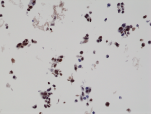 Immunohistochemistry staining of naive HepG2 cells (Negative control) using anti-His-Tag antibody, RM146.