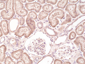Immunohistochemical staining of formalin fixed and paraffin embedded human kidney tissue section using anti-B-raf rabbit monoclonal antibody (Clone RM308) at a 1:500 dilution.