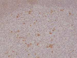 Immunohistochemical staining of formalin fixed and paraffin embedded human tonsil tissue section using anti-OX40 rabbit monoclonal antibody (Clone RM313) at a 1:500 dilution.