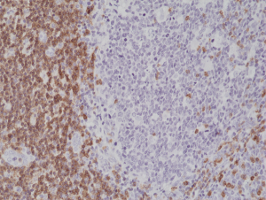 Immunohistochemical staining of formalin fixed and paraffin embedded human tonsil tissue section using anti-CD5 rabbit monoclonal antibody (Clone RM314) at a 1:1000 dilution.