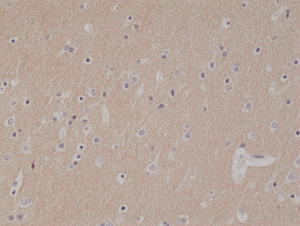 Immunohistochemical staining of formalin fixed and paraffin embedded human brain tissue section using anti-CD56 rabbit monoclonal antibody (Clone RM315) at a 1:1000 dilution.