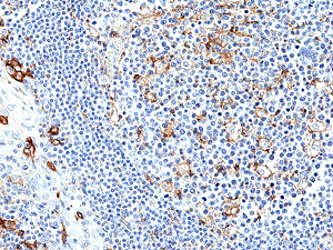 Immunohistochemical staining of formalin fixed and paraffin embedded human tonsil tissue section using anti-PD-L1 rabbit monoclonal antibody (Clone RM320) at a 1:250 dilution.