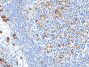 Immunohistochemical staining of formalin fixed and paraffin embedded human tonsil tissue section using anti-PD-L1 rabbit monoclonal antibody (Clone RM320) at a 1:250 dilution. Immunohistochemical staining of formalin fixed and paraffin embedded human tonsil tissue section using anti-PD-L1 rabbit monoclonal antibody (Clone RM320) at a 1:250 dilution.