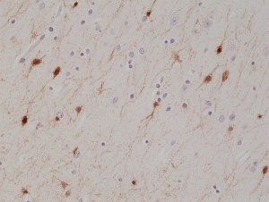 Immunohistochemical staining of formalin fixed and paraffin embedded human brain tissue section using anti-Calretinin rabbit monoclonal antibody (Clone RM324) at a 1:1000 dilution.