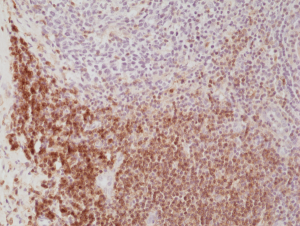 Immunohistochemical staining of formalin fixed and paraffin embedded human Tonsil tissue section using anti-CD4 rabbit monoclonal antibody (CloneRM345) at a 1:500 dilution.