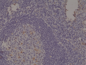 Immunohistochemical staining of formalin fixed and paraffin embedded human Tonsil tissue section using anti-Spastin rabbit monoclonal antibody (Clone RM346) at a 1:1000 dilution.