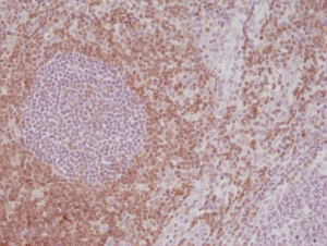 Immunohistochemical staining of formalin fixed and paraffin embedded human tonsil tissue section using anti-CD5 rabbit monoclonal antibody (Clone RM354) at a 1:500 dilution.
