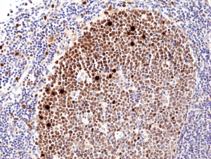 Immunohistochemical staining of formalin fixed and paraffin embedded human tonsil tissue sections, using anti-Ki-67 Rabbit Monoclonal Antibody (Clone RM360) at a 1:1000 dilution.