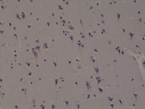 Immunohistochemical staining of formalin fixed and paraffin embedded human brain tissue section using anti-ALK rabbit monoclonal antibody (Clone RM361) at a 1:1000 dilution.