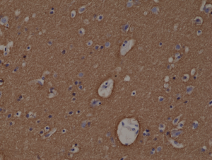 Immunohistochemical staining of formalin fixed and paraffin embedded human brain tissue section using anti-Syntaxin-1A rabbit monoclonal antibody (Clone RM367) at a 1:1000 dilution.