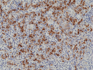 Immunohistochemical staining of formalin fixed and paraffin embedded human spleen tissue section using anti-CD163 rabbit monoclonal antibody (Clone RM371) at a 1:1000 dilution.