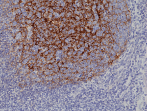 Immunohistochemical staining of formalin fixed and paraffin embedded human tonsil tissue section using anti-CD21 rabbit monoclonal antibody (Clone RM372) at a 1:1000 dilution.