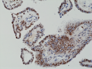 Immunohistochemical staining of formalin fixed and paraffin embedded human thyroid tissue section using anti-c-Fos rabbit monoclonal antibody (Clone RM374) at a 1:1250 dilution.