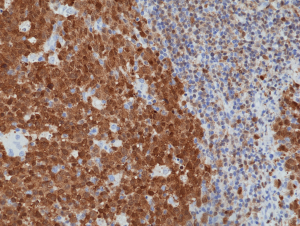 Immunohistochemical staining of formalin fixed and paraffin embedded human tonsil tissue section using anti-BOB-1/OBF-1 rabbit monoclonal antibody (Clone RM378) at a 1:1250 dilution.