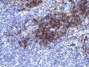 Immunohistochemical staining of formalin fixed and paraffin embedded human thymus tissue section using anti-TdT rabbit monoclonal antibody (Clone RM379) at a 1:200 dilution.