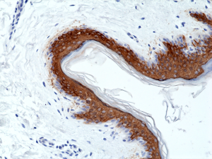 Immunohistochemical staining of formalin fixed and paraffin embedded human skin tissue section using anti-CK-10 rabbit monoclonal antibody (Clone RM386) at a 1:1000 dilution.