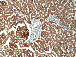 Immunohistochemical staining of formalin fixed and paraffin embedded human liver tissue section using anti-CPS1 rabbit monoclonal antibody (Clone RM395) at a 1:100 dilution.