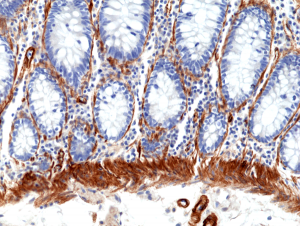 Immunohistochemical staining of formalin fixed and paraffin embedded human colon tissue section using anti-CALD1 rabbit monoclonal antibody (Clone RM396) at a 1:100 dilution.