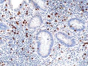 Immunohistochemical staining of formalin fixed and paraffin embedded human appendix tissue section using anti-CD8a rabbit monoclonal antibody (Clone RM397) at a 1:100 dilution.