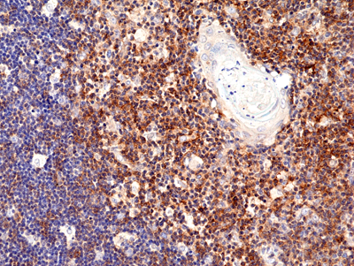 Immunohistochemical staining of formalin fixed and paraffin embedded human liver section using Anti-CD13 Rabbit Monoclonal Antibody (Clone RM403) at a 1:200 dilution.