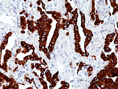 Immunohistochemical staining of formalin fixed and paraffin embedded human tonsil section using Anti-CD14 Rabbit Monoclonal Antibody (Clone RM415) at a 1:250 dilution.