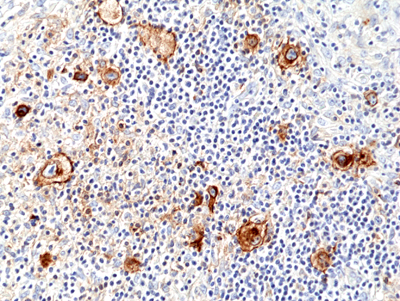 Immunohistochemical staining of formalin fixed and paraffin embedded human tonsil tissue section using anti-CD278 rabbit monoclonal antibody (Clone RM417) at a 1:100 dilution.