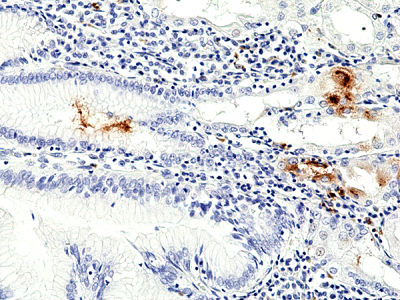 Immunohistochemical staining of formalin fixed and paraffin embedded human stomach using anti-H.Pylori rabbit monoclonal antibody (Clone RM429) at a 1:100.