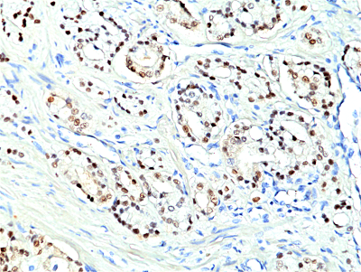 anti-Nkx3.1 Rabbit Monoclonal (RM430)