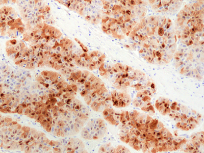 anti-HSP70 (human), Rabbit Monoclonal (RM432)