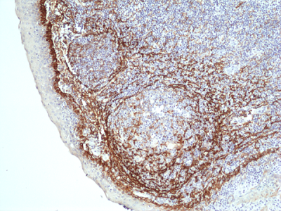 anti-Podoplanin (gp36), Rabbit Monoclonal (RM449)