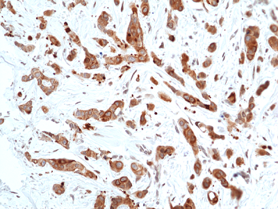 anti-Phospho-GSK-3beta (Ser9), Rabbit Monoclonal (RM453)