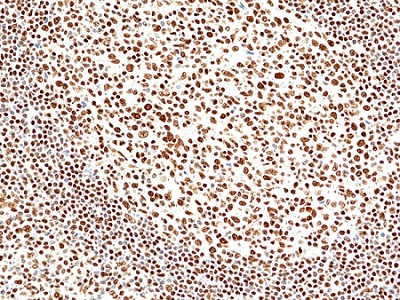 Immunohistochemical staining of formalin fixed and paraffin embedded human tonsil tissue sections using Anti-INI1 antibody (RM468) at 1:100 dilution.