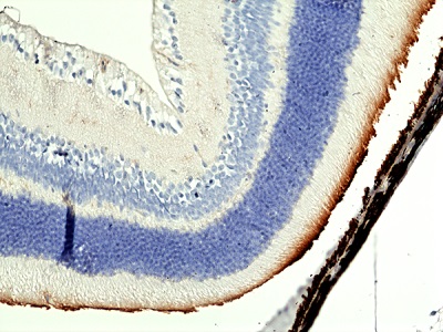 Immunohistochemical staining of formalin fixed and paraffin embedded mouse eye tissue sections using Anti-mouse MerTK antibody (RM469) at 1:100 dilution.