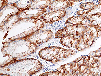 Immunohistochemical staining of formalin fixed and paraffin embedded human stomach tissue sections using anti-CA9 rabbit monoclonal antibody (RM486) at 1:100 dilution.