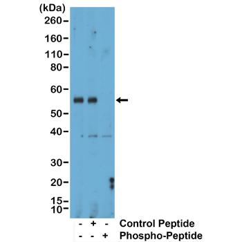 Western Blot of mouse liver tissue lysate, using Anti-Phospho-Smad1 (Ser463/465)/Smad5 (Ser463/465)/Smad9 (Ser465/467) rabbit monoclonal antibody (clone RM487) at a 1:1000 dilution. The phospho-specificity of RM487 was verified by peptide blocking using a control nonphospho-peptide or phosphor-peptide targeting residue Ser463/465 of Smad1 and Smad5 and residue Ser465/467 of Smad9.