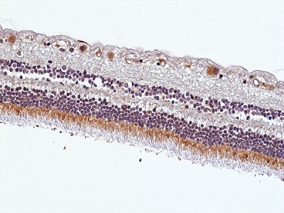 Immunohistochemical staining of formalin-fixed and paraffin-embedded human eye retina tissue sections using anti-Human MerTK Rabbit Monoclonal Antibody (Clone RM506) at 1:100 dilution.